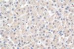 PLOD2 Antibody in Immunohistochemistry (Paraffin) (IHC (P))