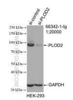 PLOD2 Antibody in Western Blot (WB)