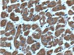 CLIC4 Antibody in Immunohistochemistry (Paraffin) (IHC (P))