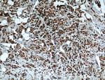MKP-2 Antibody in Immunohistochemistry (Paraffin) (IHC (P))