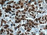 MKP-2 Antibody in Immunohistochemistry (Paraffin) (IHC (P))