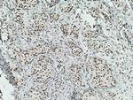 MKP-2 Antibody in Immunohistochemistry (Paraffin) (IHC (P))