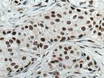 MKP-2 Antibody in Immunohistochemistry (Paraffin) (IHC (P))