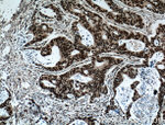 MKP-2 Antibody in Immunohistochemistry (Paraffin) (IHC (P))
