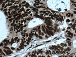 MKP-2 Antibody in Immunohistochemistry (Paraffin) (IHC (P))