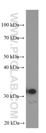 MKP-2 Antibody in Western Blot (WB)
