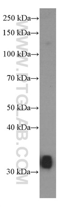 MKP-2 Antibody in Western Blot (WB)