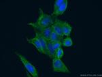 CAPRIN1 Antibody in Immunocytochemistry (ICC/IF)