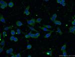 CBLB Antibody in Immunocytochemistry (ICC/IF)
