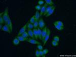 POMC Antibody in Immunocytochemistry (ICC/IF)
