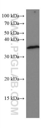 POMC Antibody in Western Blot (WB)