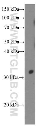 POMC Antibody in Western Blot (WB)