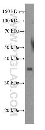 POMC Antibody in Western Blot (WB)