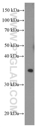 POMC Antibody in Western Blot (WB)