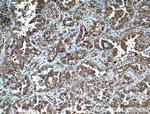 Tubulin beta class V Antibody in Immunohistochemistry (Paraffin) (IHC (P))