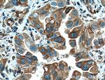 Tubulin beta class V Antibody in Immunohistochemistry (Paraffin) (IHC (P))
