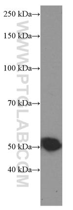Tubulin beta class V Antibody in Western Blot (WB)