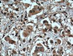 Tubulin beta class V Antibody in Immunohistochemistry (Paraffin) (IHC (P))