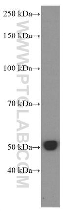 Tubulin beta class V Antibody in Western Blot (WB)