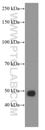 Tubulin beta class V Antibody in Western Blot (WB)