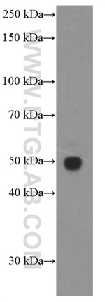 Tubulin beta class V Antibody in Western Blot (WB)