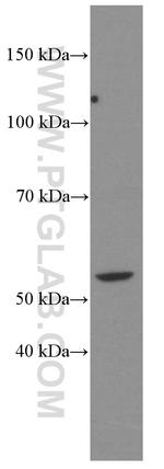D2HGDH Antibody in Western Blot (WB)