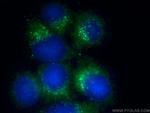 ERp72 Antibody in Immunocytochemistry (ICC/IF)