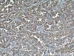 ERp72 Antibody in Immunohistochemistry (Paraffin) (IHC (P))