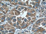 ERp72 Antibody in Immunohistochemistry (Paraffin) (IHC (P))