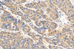 ERp72 Antibody in Immunohistochemistry (Paraffin) (IHC (P))
