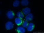 ERp72 Antibody in Immunocytochemistry (ICC/IF)