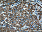 ERp72 Antibody in Immunohistochemistry (Paraffin) (IHC (P))
