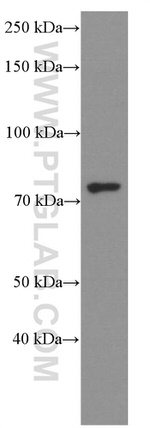 ERp72 Antibody in Western Blot (WB)