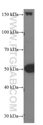 SKAP2 Antibody in Western Blot (WB)