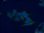 G6PD Antibody in Immunocytochemistry (ICC/IF)