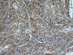G6PD Antibody in Immunohistochemistry (Paraffin) (IHC (P))
