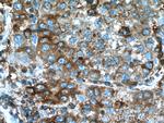 G6PD Antibody in Immunohistochemistry (Paraffin) (IHC (P))