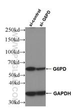 G6PD Antibody in Western Blot (WB)