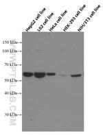 G6PD Antibody in Western Blot (WB)