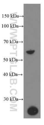 G6PD Antibody in Western Blot (WB)