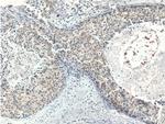TINP1 Antibody in Immunohistochemistry (Paraffin) (IHC (P))