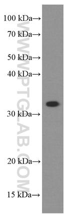 TINP1 Antibody in Western Blot (WB)