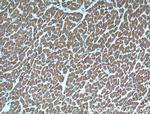 Cardiac Troponin I Antibody in Immunohistochemistry (Paraffin) (IHC (P))