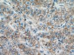 beta-Catenin Antibody in Immunohistochemistry (Paraffin) (IHC (P))
