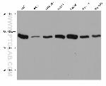 beta-Catenin Antibody in Western Blot (WB)