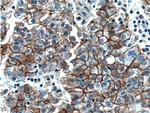beta-Catenin Antibody in Immunohistochemistry (Paraffin) (IHC (P))