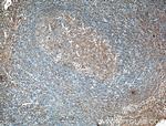 MICA Antibody in Immunohistochemistry (Paraffin) (IHC (P))