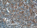 MICA Antibody in Immunohistochemistry (Paraffin) (IHC (P))