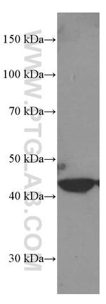 MICA Antibody in Western Blot (WB)