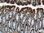 MICA Antibody in Immunohistochemistry (Paraffin) (IHC (P))
